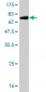 SPP1 Antibody (monoclonal) (M06)